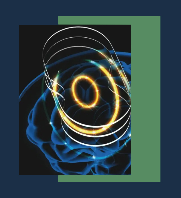 Clinical experience with TMS Neuronavigation
